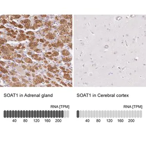 Merck Anti-SOAT1 antibody produced in rabbit