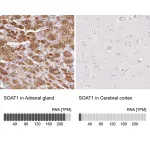 Merck Anti-SOAT1 antibody produced in rabbit