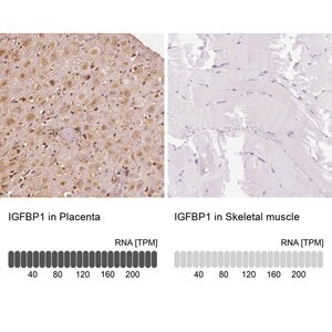 Merck Anti-IGFBP1 antibody produced in rabbit