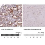 Merck Anti-LGALS9 antibody produced in rabbit
