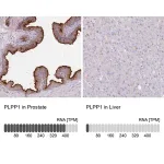 Merck Anti-PLPP1 antibody produced in rabbit