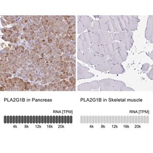 Merck Anti-PLA2G1B antibody produced in rabbit