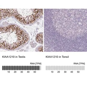 Merck Anti-KIAA1210 antibody produced in rabbit