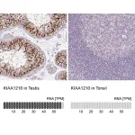 Merck Anti-KIAA1210 antibody produced in rabbit