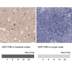 Merck Anti-CEP170B antibody produced in rabbit