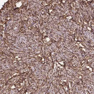 Merck Anti-RBP1 antibody produced in rabbit