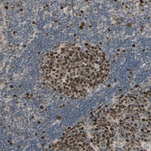 Merck Anti-RAD18 antibody produced in rabbit