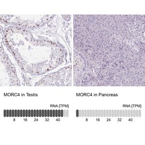 Merck Anti-MORC4 antibody produced in rabbit