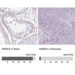 Merck Anti-MORC4 antibody produced in rabbit