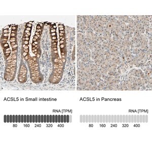 Merck Anti-ACSL5 antibody produced in rabbit