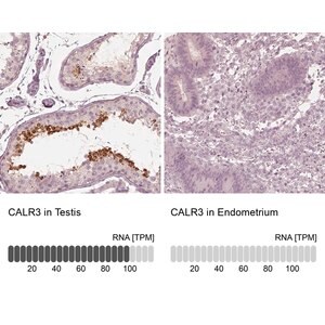 Merck Anti-CALR3 antibody produced in rabbit