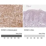 Merck Anti-KCNQ1 antibody produced in rabbit