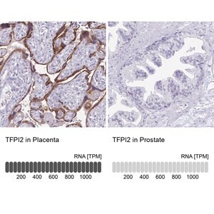 Merck Anti-TFPI2 antibody produced in rabbit
