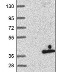Merck Anti-ANKRD29 antibody produced in rabbit