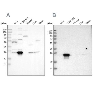 Merck Anti-BAG2 antibody produced in rabbit