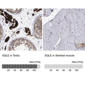 Merck Anti-SQLE antibody produced in rabbit