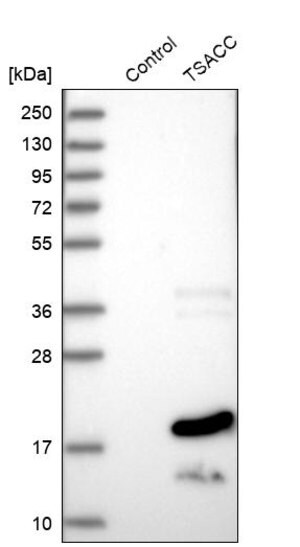 Merck Anti-TSACC antibody produced in rabbit