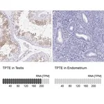 Merck Anti-TPTE antibody produced in rabbit