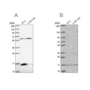 Merck Anti-MRPS16 antibody produced in rabbit