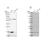 Merck Anti-MRPS16 antibody produced in rabbit