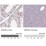 Merck Anti-ARID3B antibody produced in rabbit