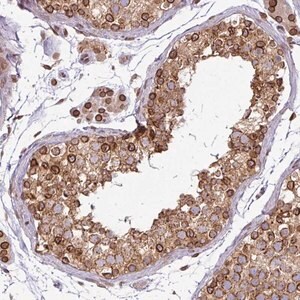 Merck Anti-RANGAP1 antibody produced in rabbit