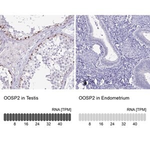 Merck Anti-OOSP2 antibody produced in rabbit
