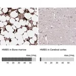 Merck Anti-HMBS antibody produced in rabbit