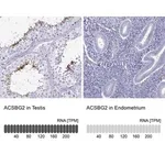 Merck Anti-ACSBG2 antibody produced in rabbit
