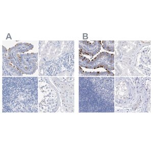 Merck Anti-C1orf87 antibody produced in rabbit