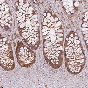 Merck Anti-PREP antibody produced in rabbit