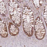 Merck Anti-PREP antibody produced in rabbit