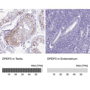 Merck Anti-DPEP3 antibody produced in rabbit