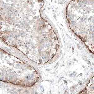 Merck Anti-LAMA1 antibody produced in rabbit