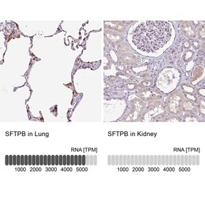 Merck Anti-SFTPB antibody produced in rabbit