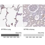 Merck Anti-SFTPB antibody produced in rabbit