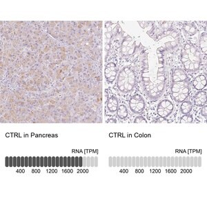 Merck Anti-CTRL antibody produced in rabbit