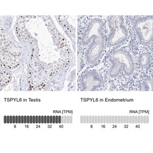 Merck Anti-TSPYL6 antibody produced in rabbit