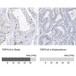 Merck Anti-TSPYL6 antibody produced in rabbit