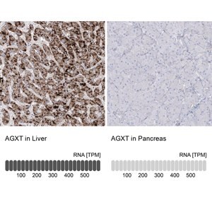 Merck Anti-AGXT antibody produced in rabbit