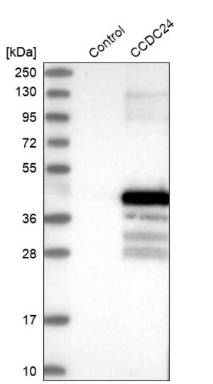 Merck Anti-CCDC24 antibody produced in rabbit