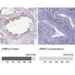 Merck Anti-ZPBP2 antibody produced in rabbit