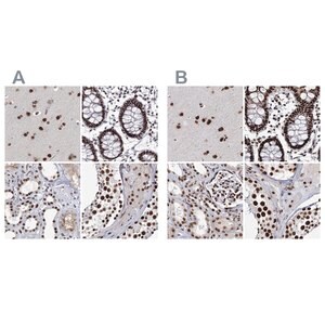 Merck Anti-SCAF8 antibody produced in rabbit