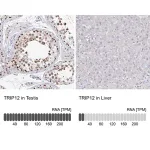 Merck Anti-TRIP12 antibody produced in rabbit