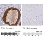 Merck Anti-TRH antibody produced in rabbit