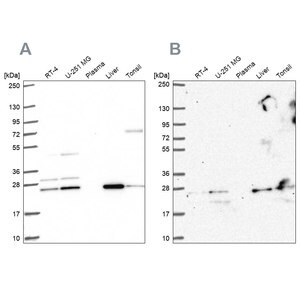 Merck Anti-CMPK1 antibody produced in rabbit