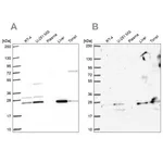 Merck Anti-CMPK1 antibody produced in rabbit