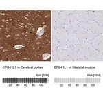 Merck Anti-EPB41L1 antibody produced in rabbit