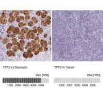 Merck Anti-TFF2 antibody produced in rabbit