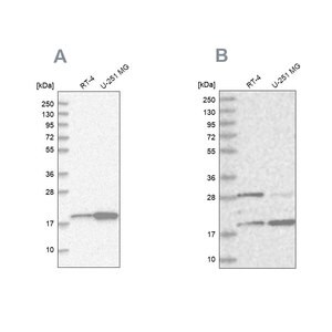 Merck Anti-CGGBP1 antibody produced in rabbit